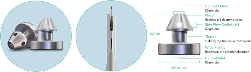 Three close ups: iStent inject W stents, insertion tube with window, and insertion sleeve tip.