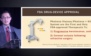 FDA-Approved Corneal Cross-Linking Procedure video by Clark Chang, OD, 2017 Vision Expo East Meeting.