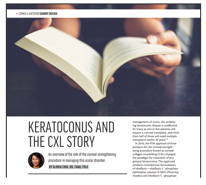Article: Keratoconus and the Cross-Linking Story by Gloria Chiu, OD, FAAO, FSLS, Modern Optometry (October 2019).
