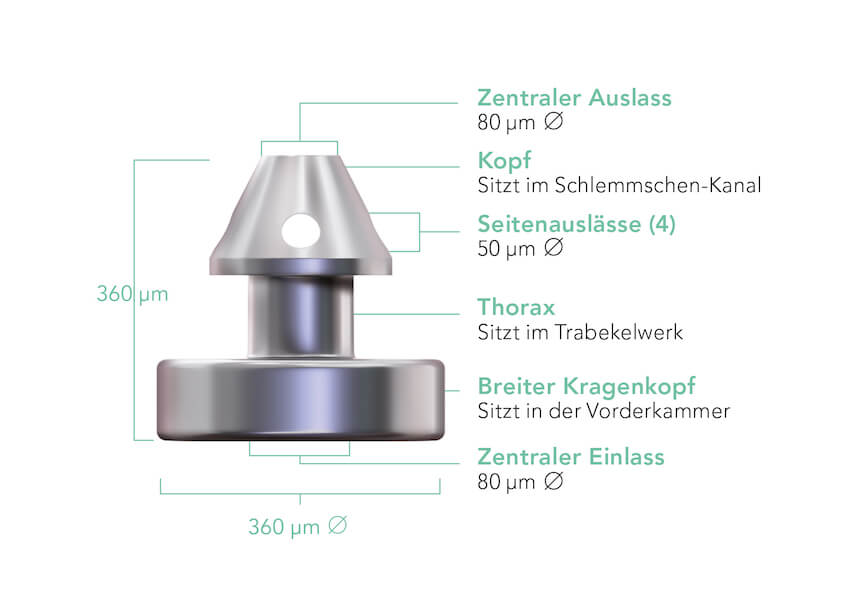 Diagram of the iStent inject W.