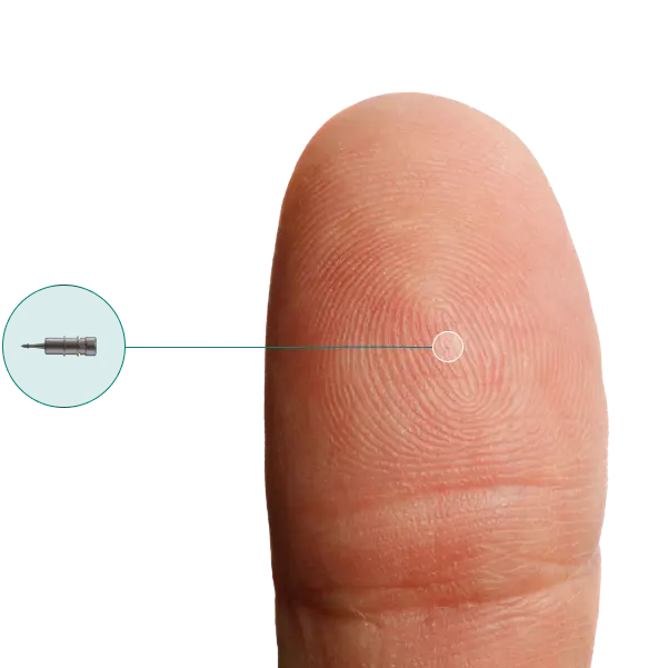 idose TR is smaller than the center of the fingerprint