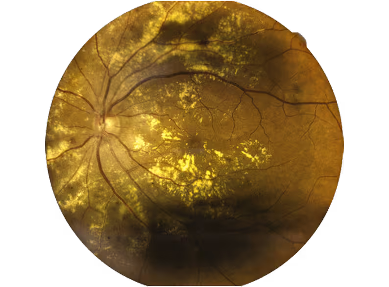 Magnified view of the retina